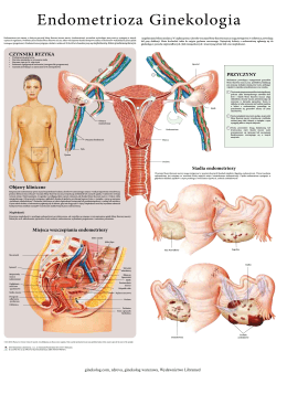 Endometrioza Ginekologia