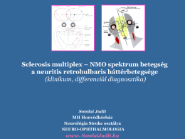 NMO spektrum betegség – a neuritis retrobulbaris