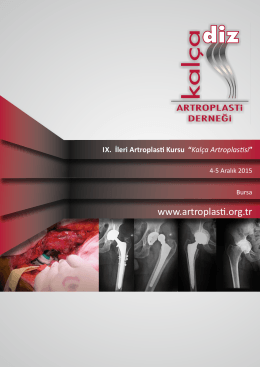 Kalça Artroplas si - artroplasti derneği