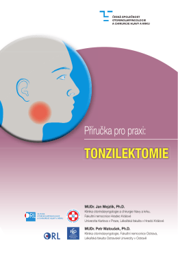 tonzilektomie - Česká společnost otorinolaryngologie a chirurgie