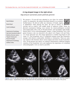 A ring-shaped image in the right atrium