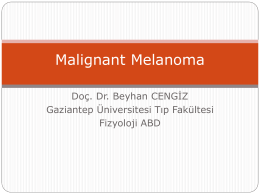 Malignant Melanoma