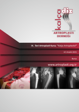 Kalça Artroplas si - artroplasti derneği