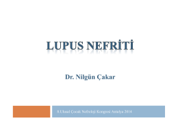 Lupus Nefriti - Çocuk Nefroloji Derneği