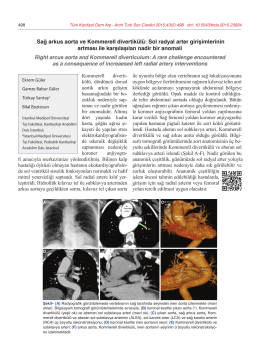 Sağ arkus aorta ve Kommerell divertikülü: Sol radyal arter